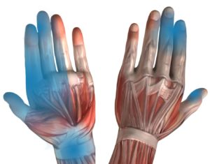 Yoga for Carpal Tunnel - Affected Pain Areas In Hand