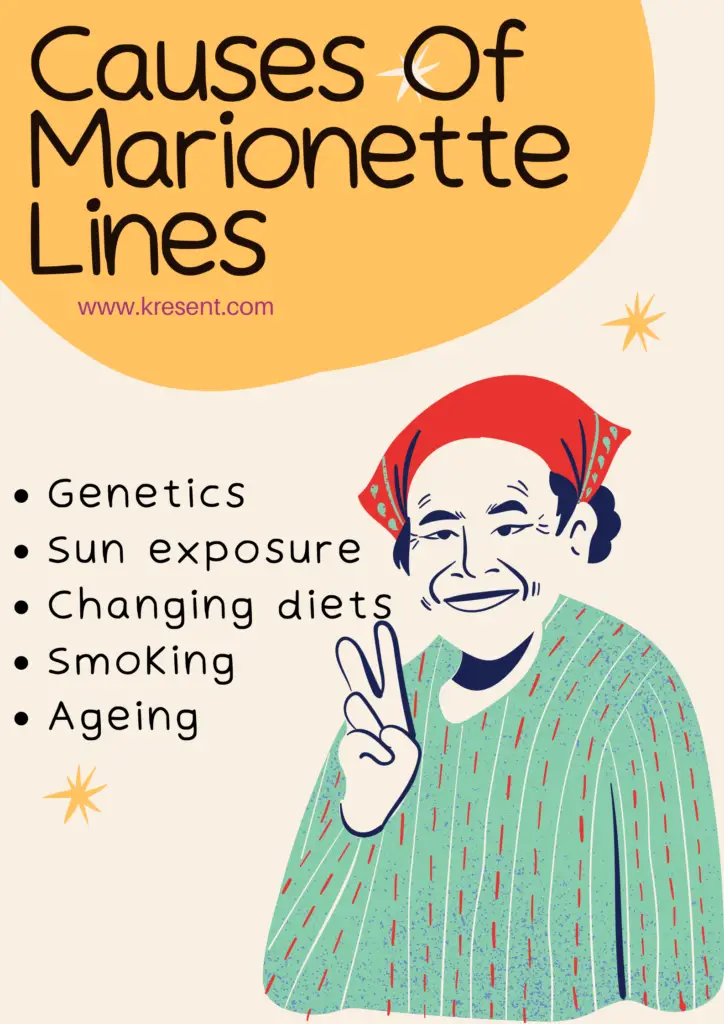 Causes Of Marionette Lines