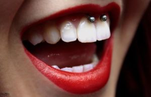 Smiley lip Piercings