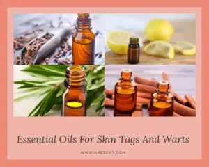 Essential Oils For Skin Tags And Warts