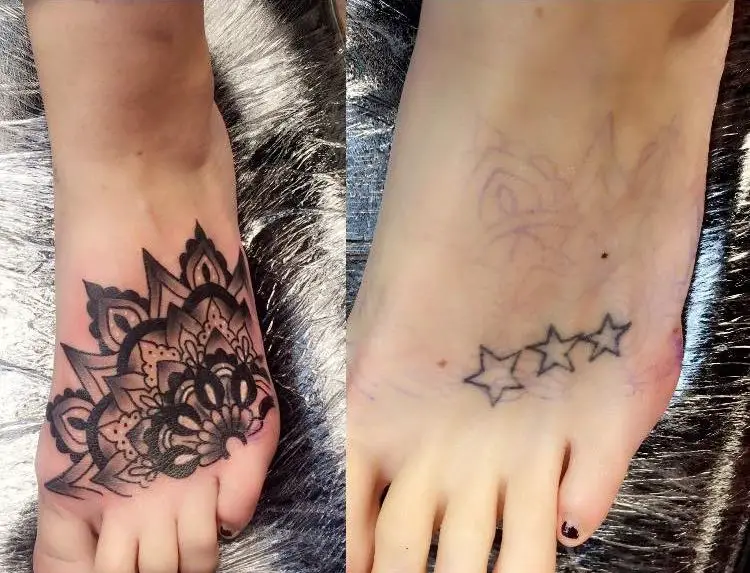 Mandala Foot Cover Up Tattoo