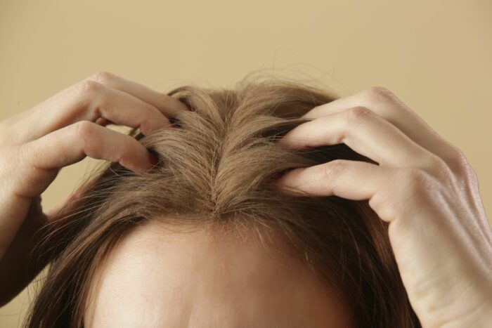 Is Baking Soda Irritating For Your Scalp?