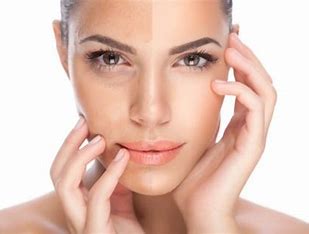 Benefits of The Ordinary Peeling Solution