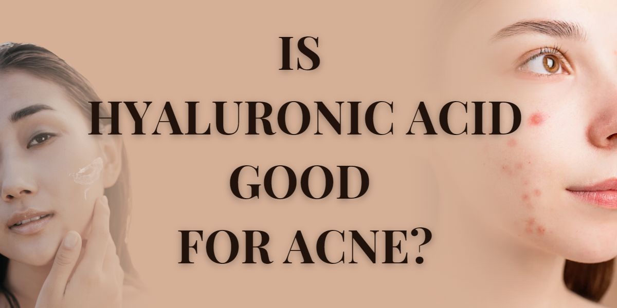 Is Hyaluronic Acid Good For Acne?
